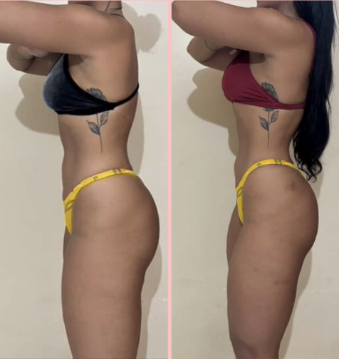 Transformação de aluna · Desafio Seca Diva
